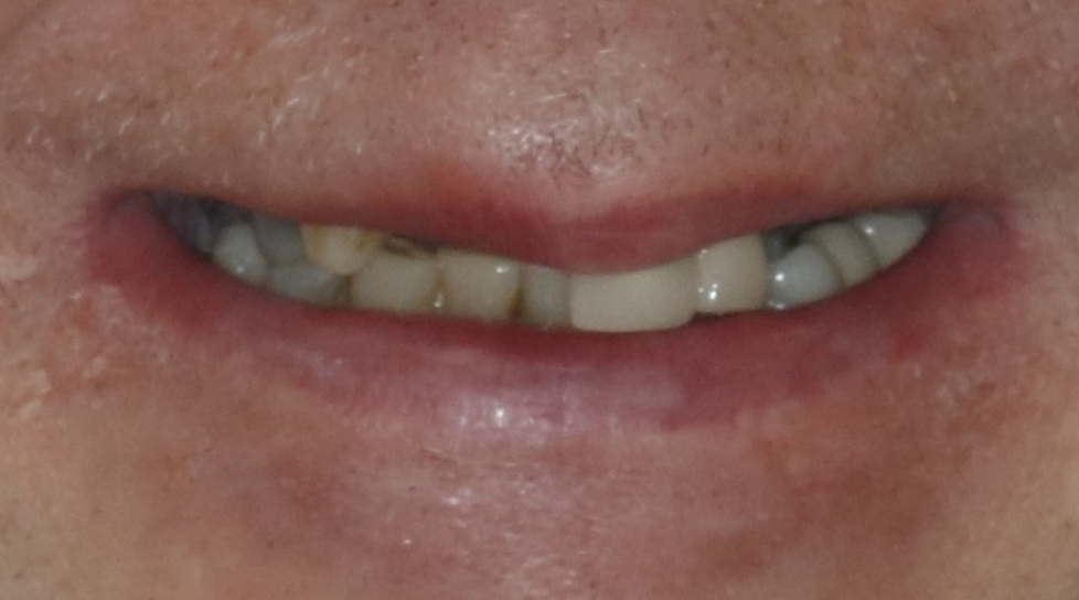 Close-up of a smiling mouth with teeth visible and slightly parted lips