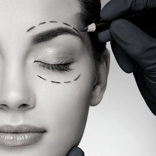 Eyelid Surgery Pretoria Plastic Surgery - Eyelid surgery - Dr Ehren Eksteen