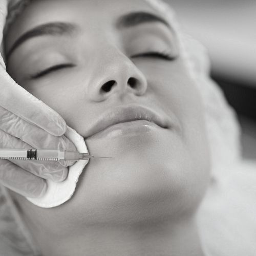 Fillers Pretoria - Dr Eksteen Plastic Surgeon
