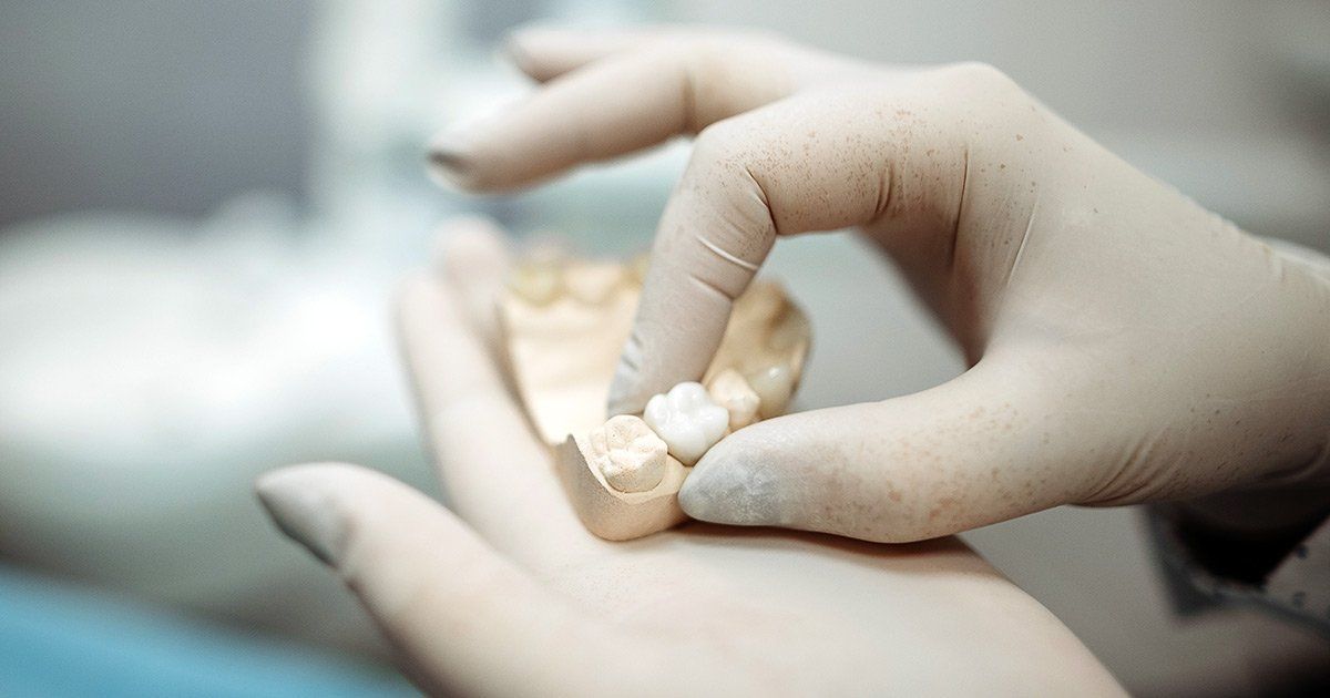 dental crowns, dentist in Bedford NH