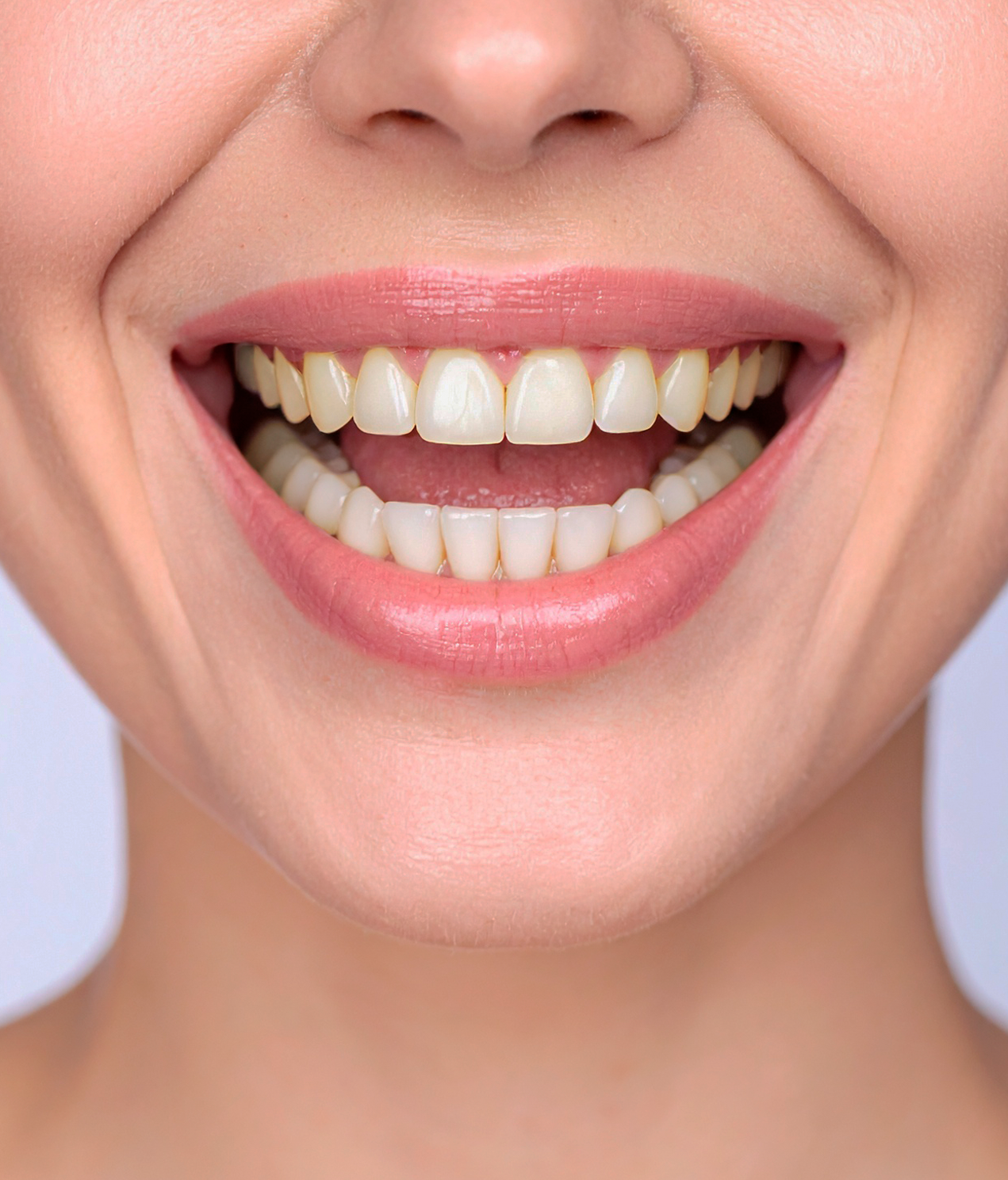 Close-up of a smiling mouth showing teeth and pink lips