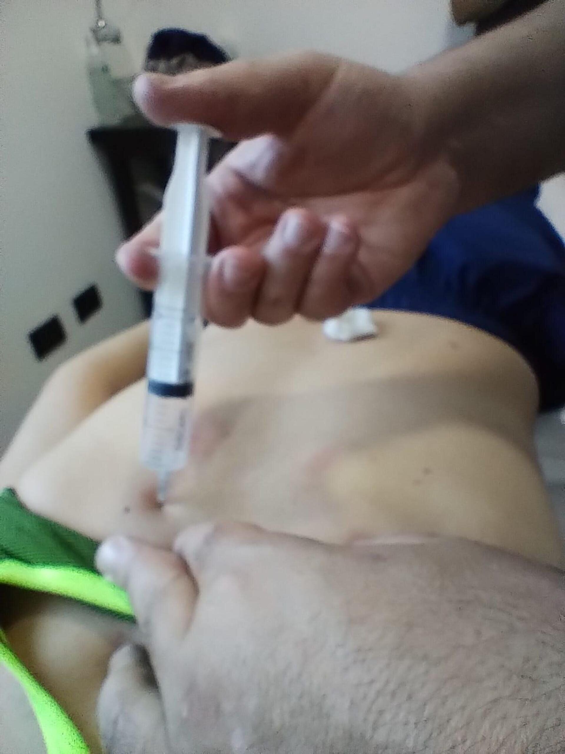 Una persona recibe una inyección en la zona lumbar de un profesional médico que sostiene una jeringa.