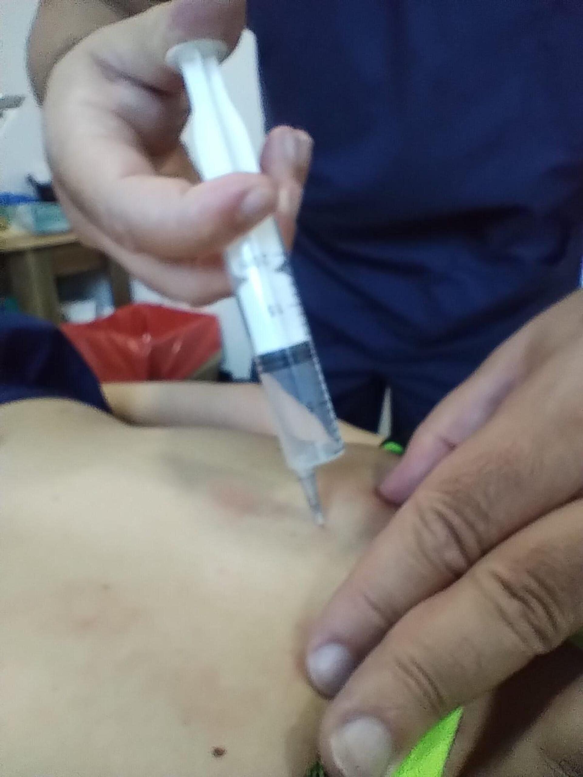 Un profesional sanitario con bata azul administra una inyección subcutánea en la zona abdominal de un paciente.