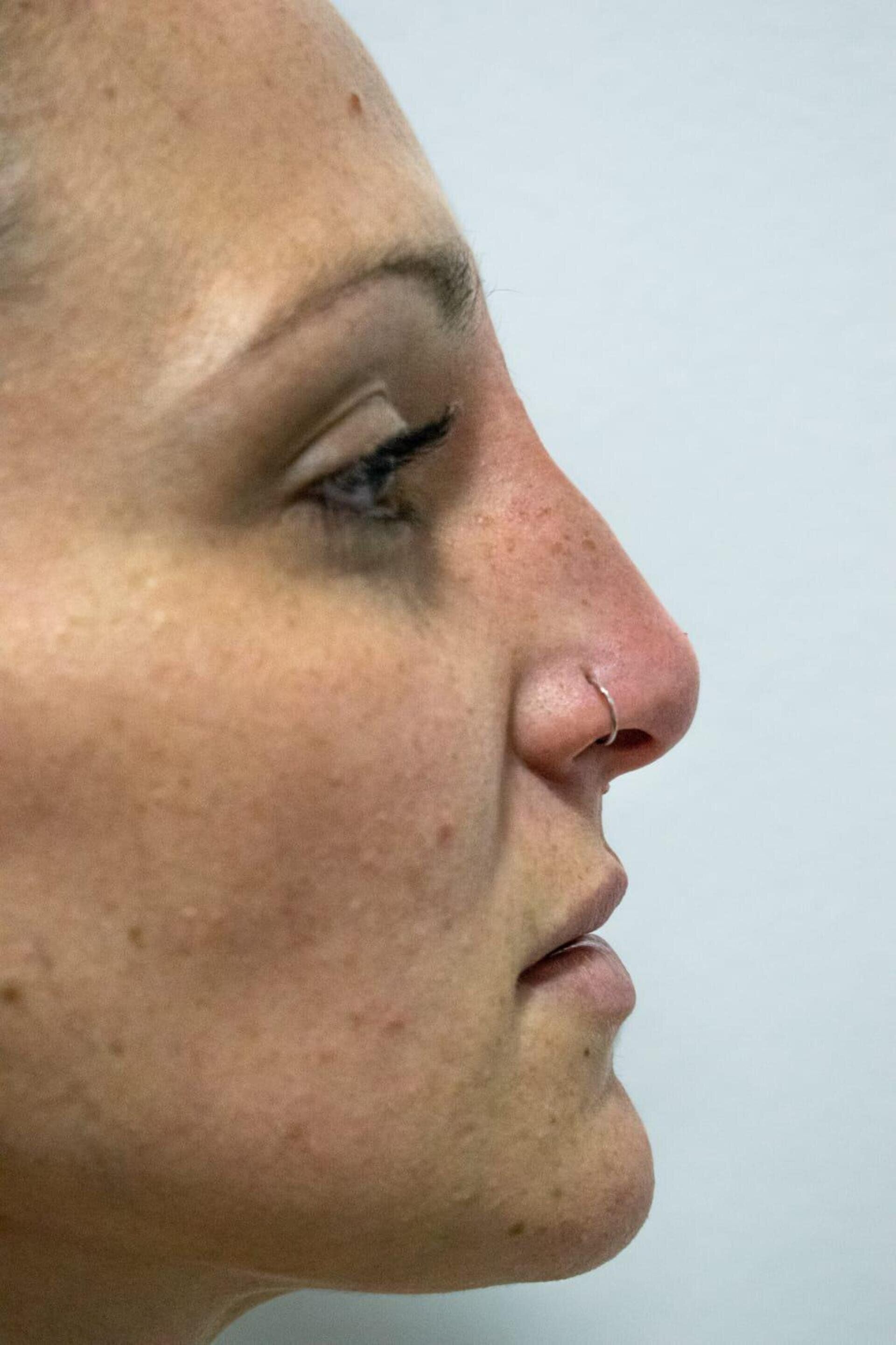 Perfil lateral de un rostro, con especial atención a la nariz, que luce un fino piercing circular en forma de aro.