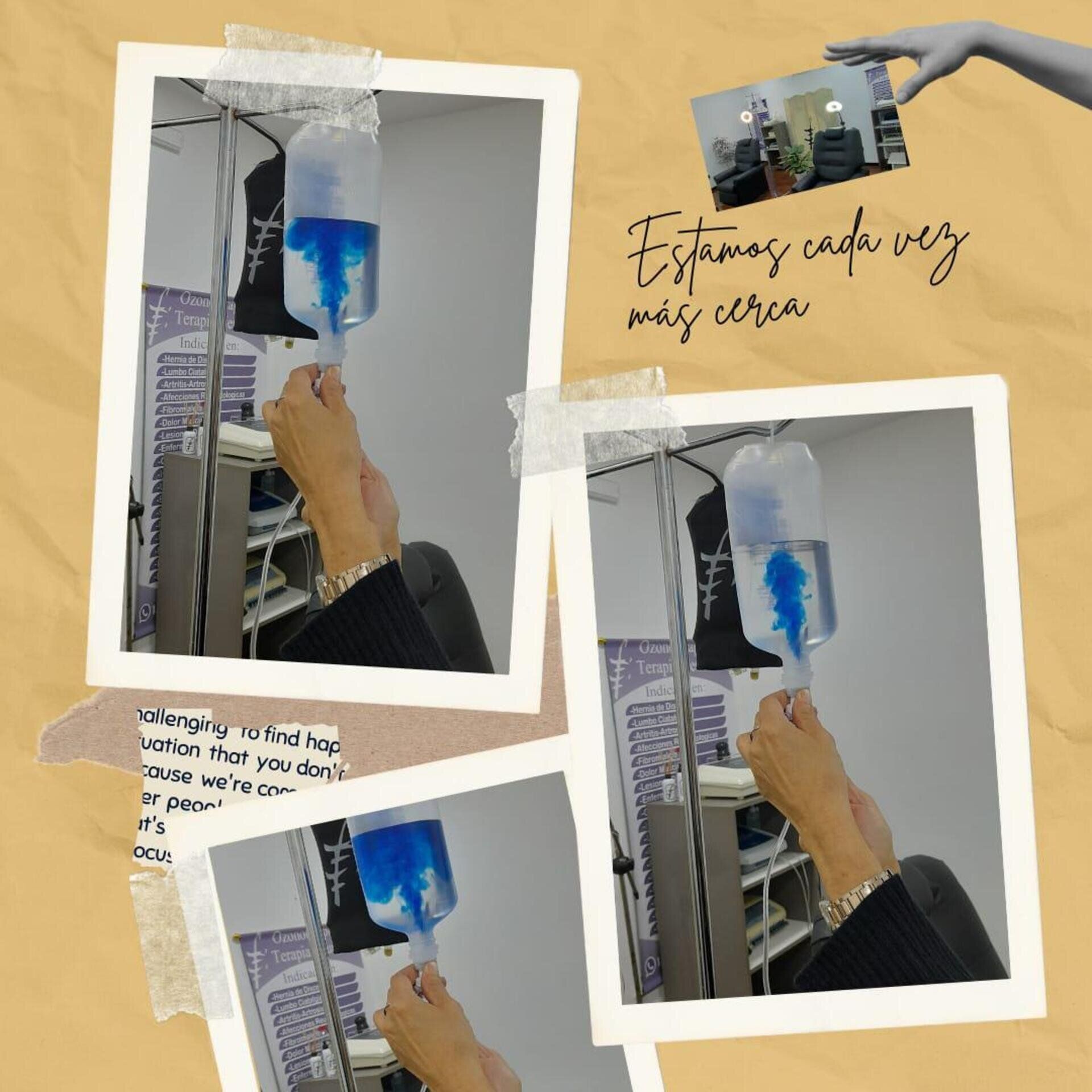 Un collage de fotos muestra a una persona inyectando líquido azul en una bolsa de suero intravenoso en un entorno clínico