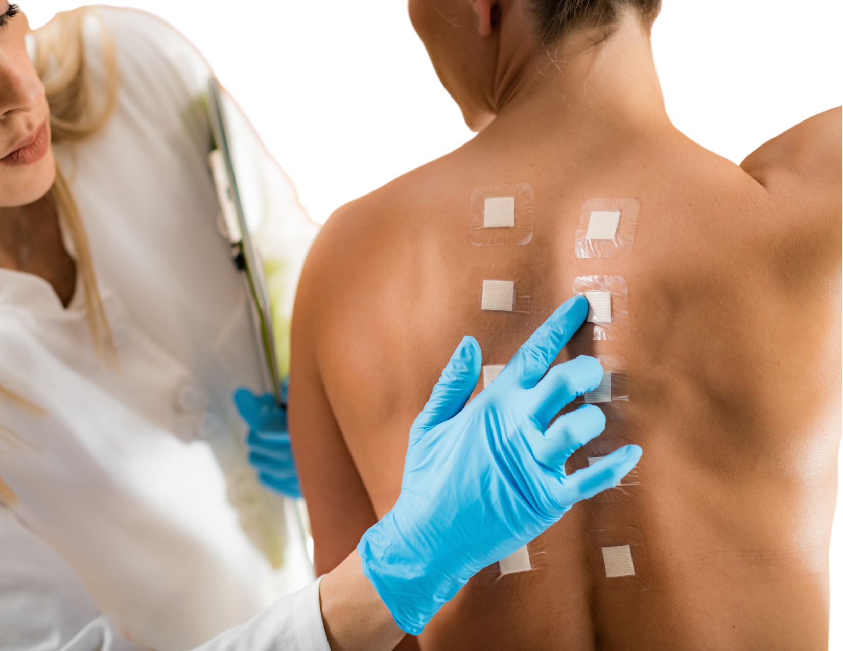 patch tests