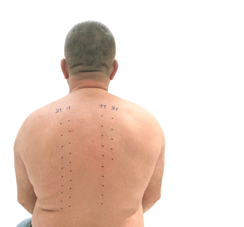 skin allergen test