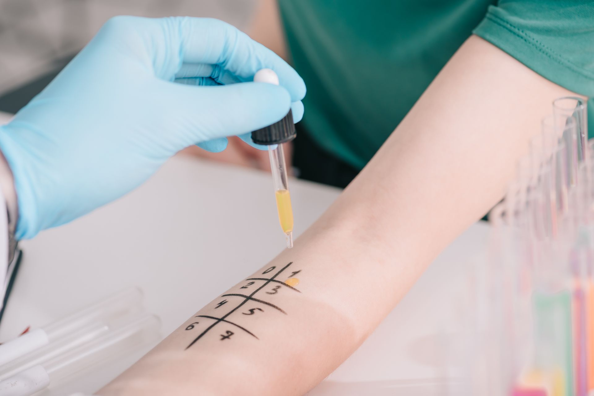 food intolerance test
