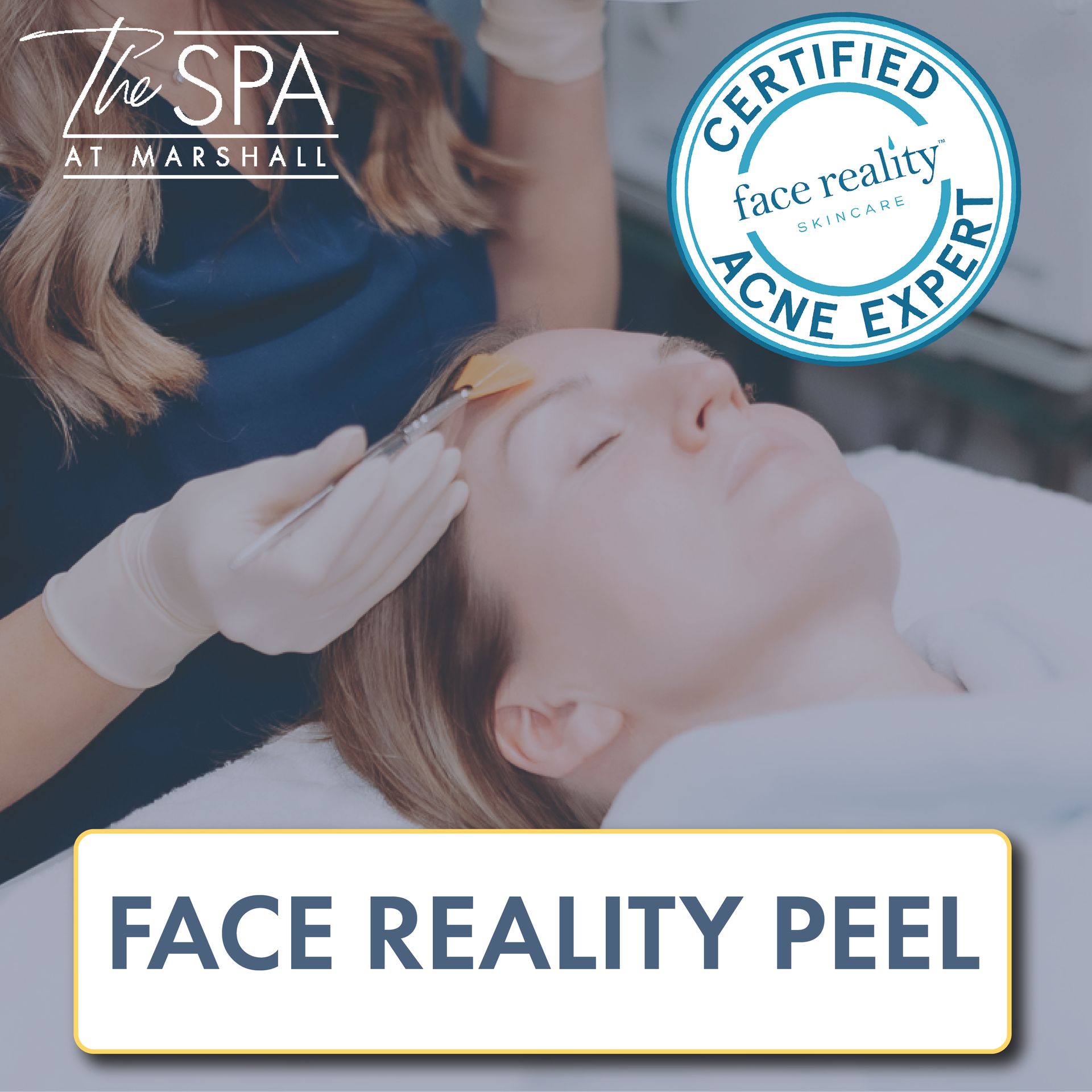 Face Reality Peel