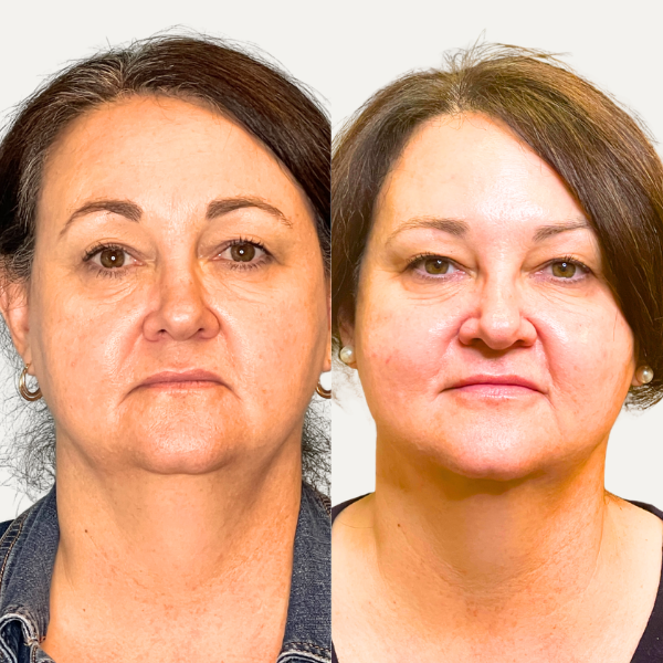 Side-by-side portrait photos of the same woman with different makeup and lighting on a white background