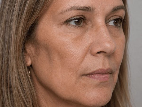 Close-up of a person’s face with a neutral expression, looking to the side against a blurred background.