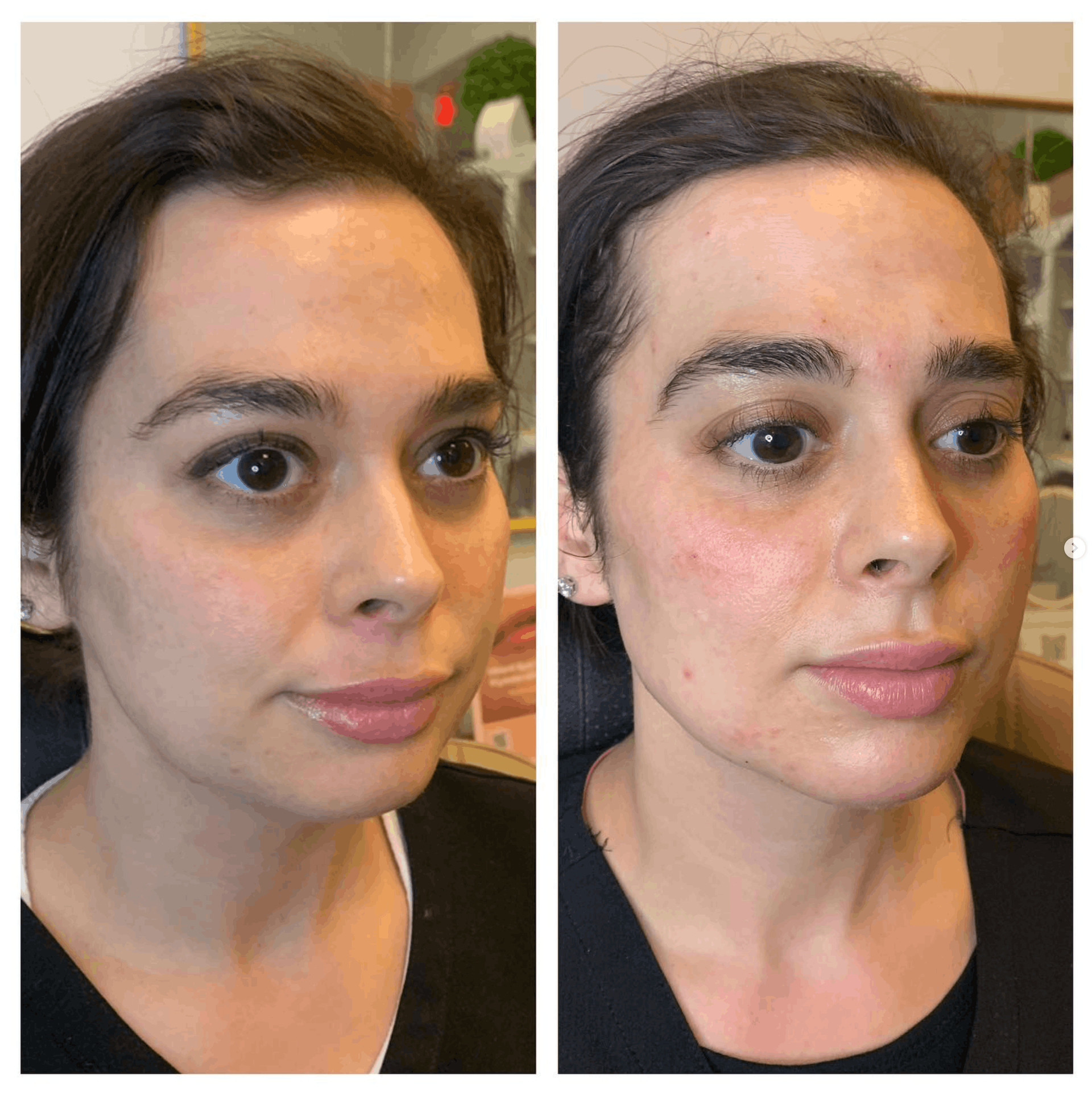 Side-by-side portrait of the same person showing a face and makeup or skin comparison.