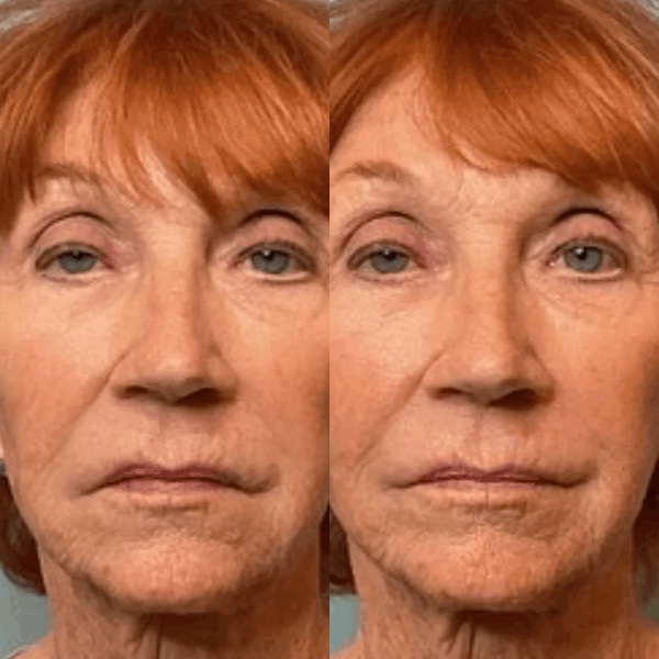 Close-up of a woman’s face shown twice side by side against a blue background