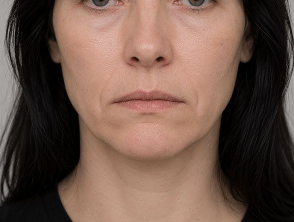 Close-up of a woman’s face with a neutral expression against a plain background