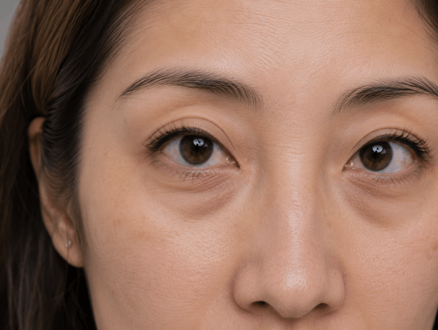 Close-up of a person’s face with a neutral expression and visible under-eye circles