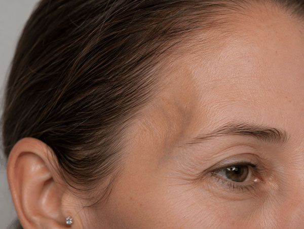 Close-up of a woman's face in profile, showing ear, eye, and forehead against a dark background