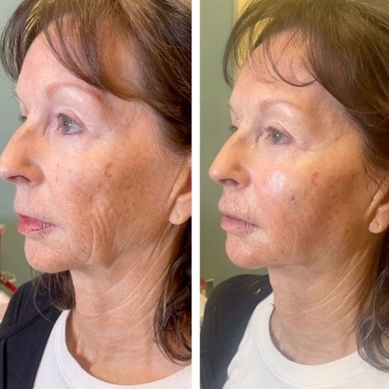 Two clinicians adjust a woman’s face during a cosmetic treatment in a clinic setting
