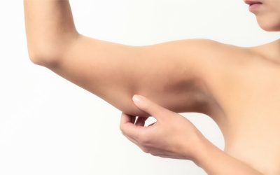 A woman is holding her arm with her hand.