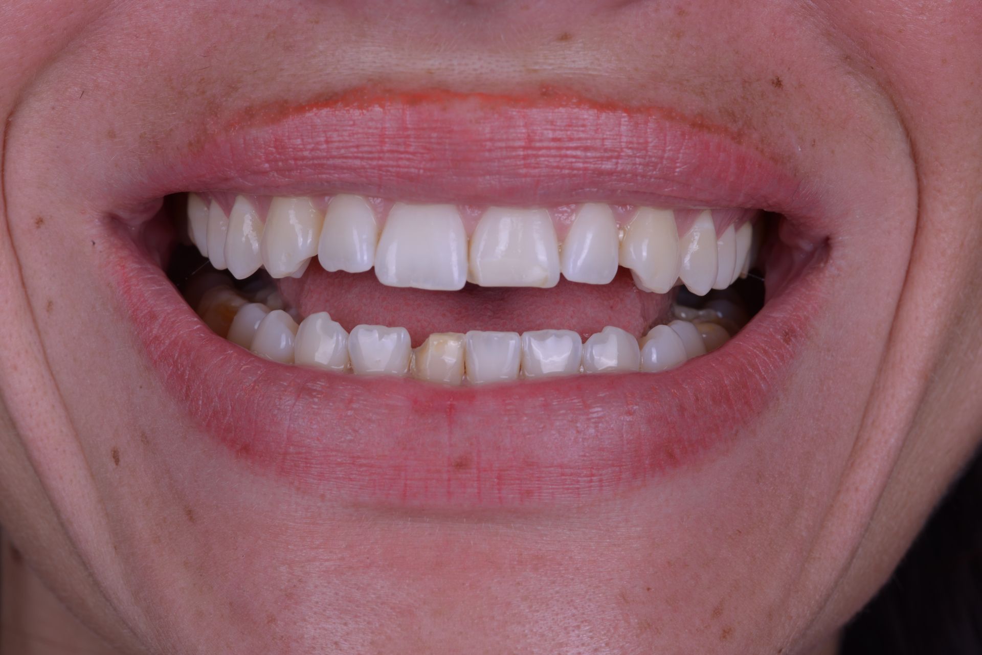 Miami Beach Dental Solutions