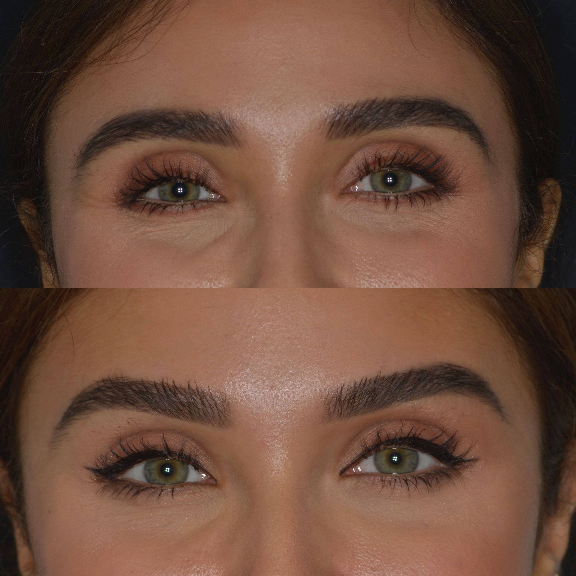 A before and after photo of a woman 's eyes.