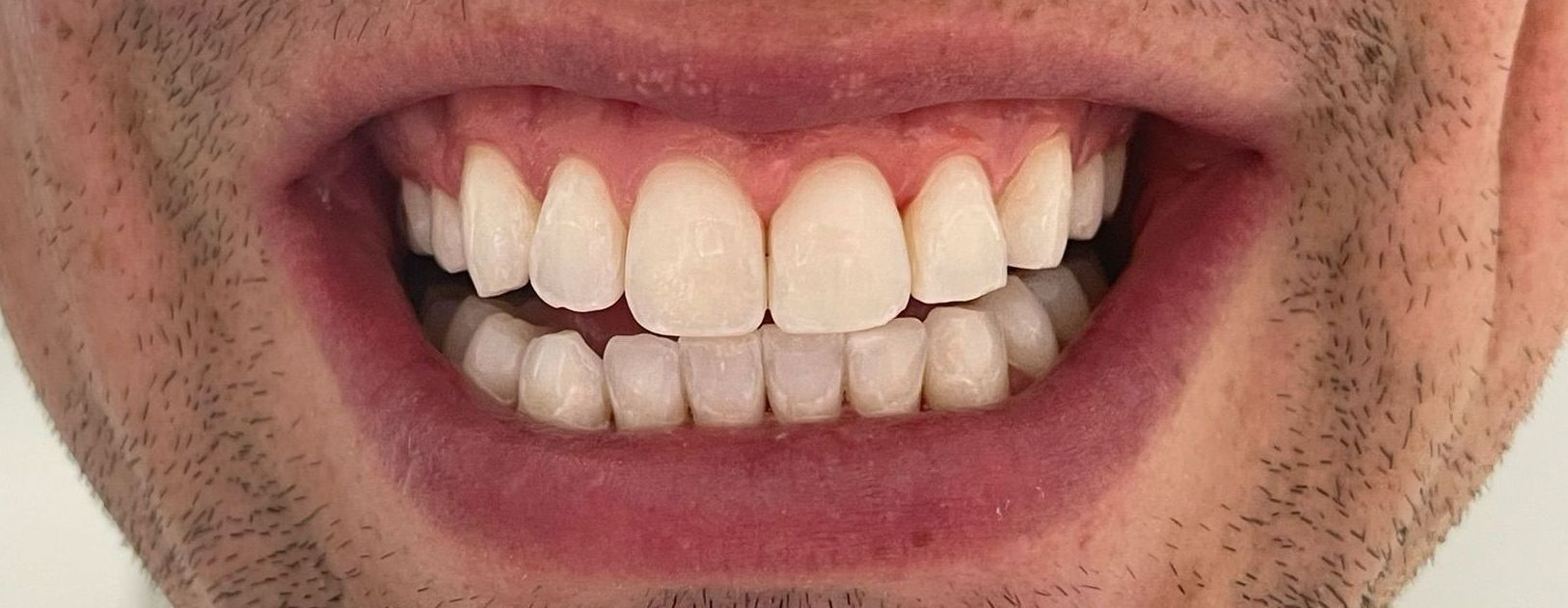 Miami Beach Dental Solutions