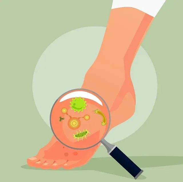 Magnifying glass examining a foot with visible germs and skin irritation, suggesting a fungal infection.