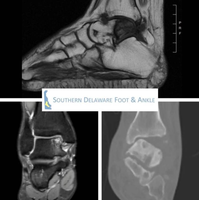 Foot and ankle MRI and CT scans with Southern Delaware Foot & Ankle label