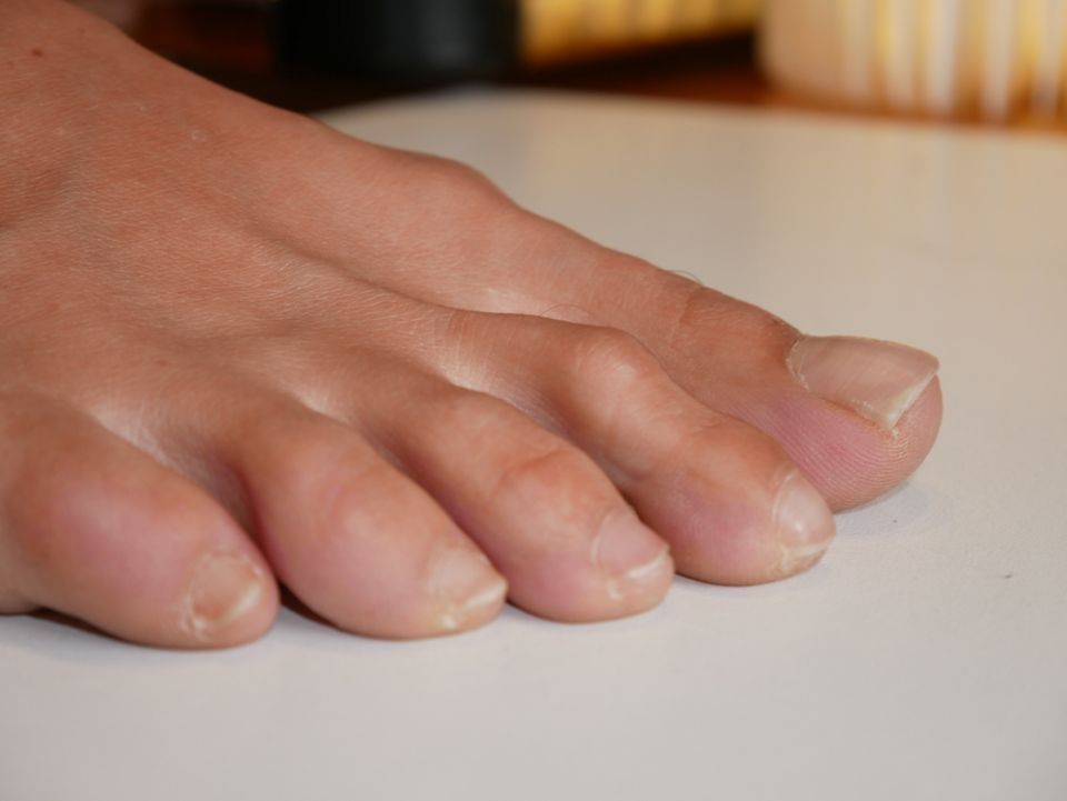 Close-up of bare toes resting on a white surface