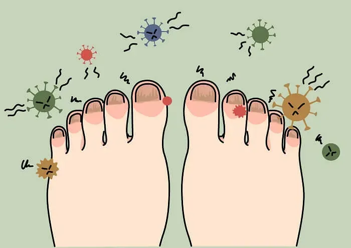Feet with red toes surrounded by cartoon germs on a light green background