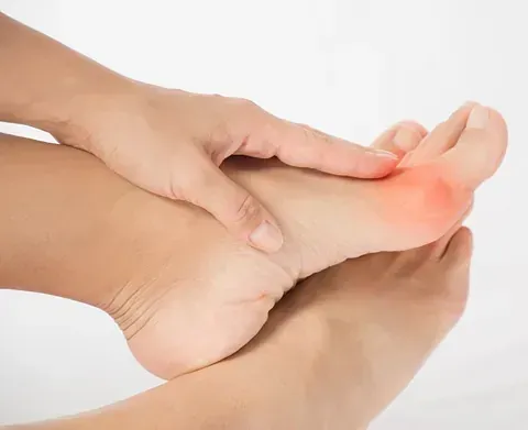 Hands massaging a swollen, red heel and foot on a white background
