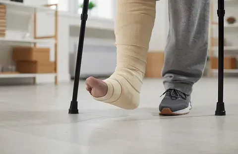 Person with a bandaged leg using crutches indoors, standing next to someone in gray pants and sneakers.