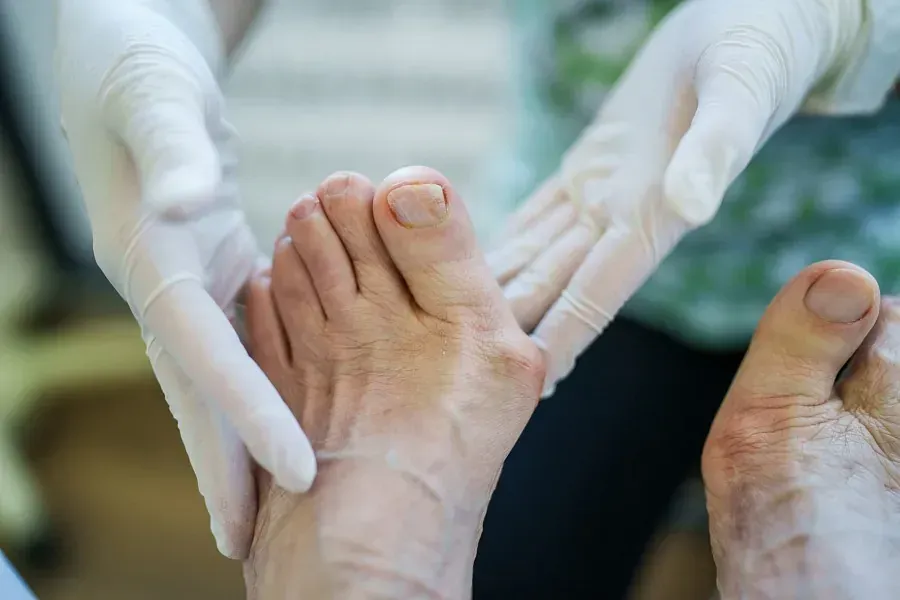 Gloved hands examining a patient’s feet during a medical checkup