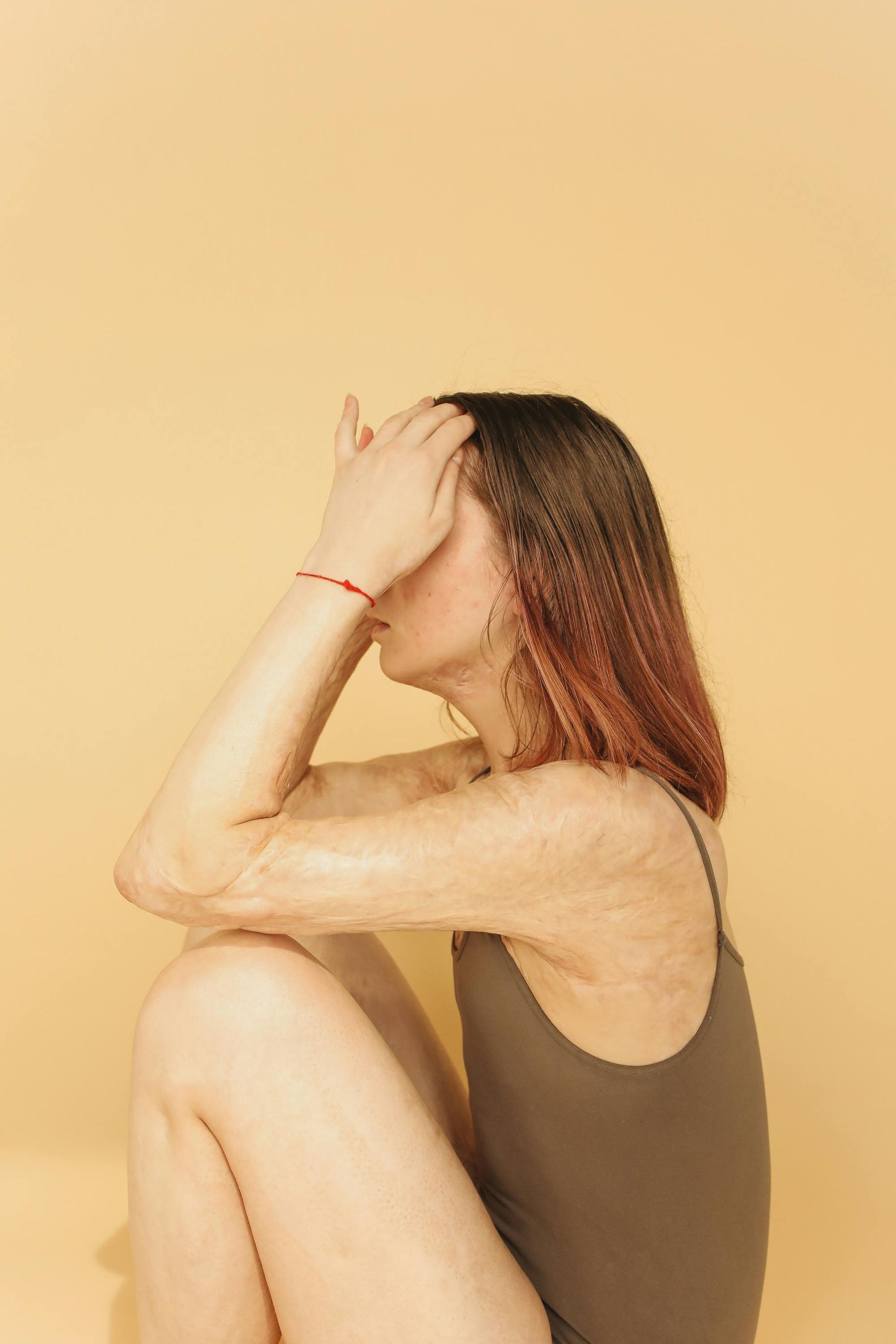 woman with head in hands emotionally stressed