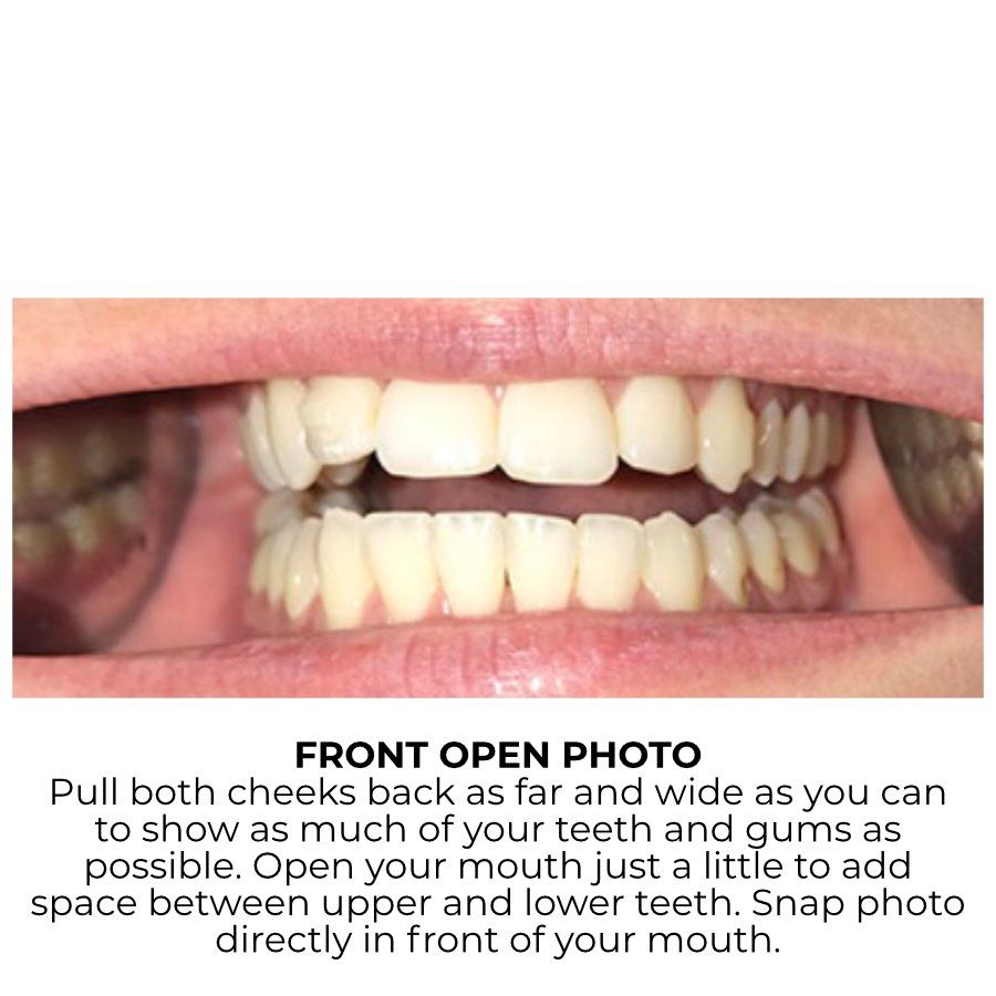 Front Open Example