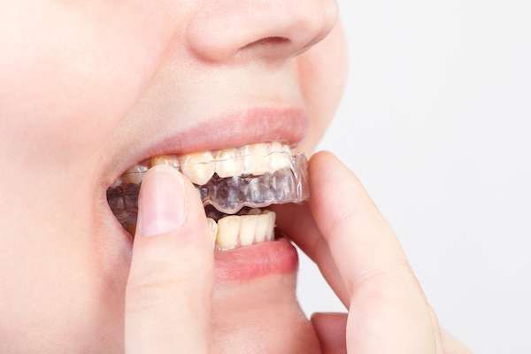 A woman is putting a clear brace on her teeth.