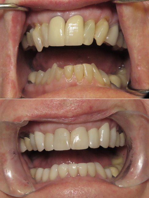 before and after dental in tucson az
