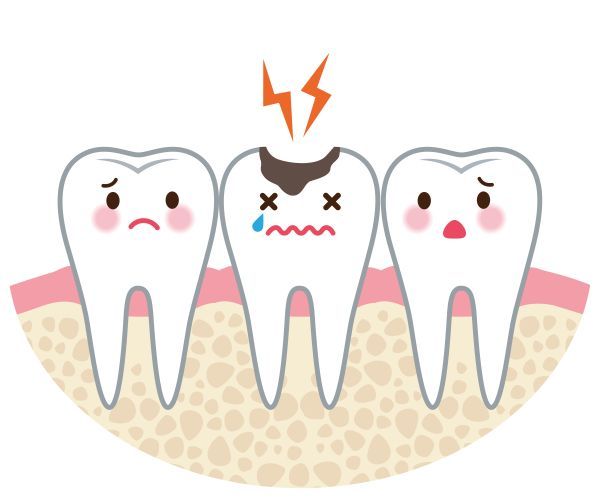 Which Dental Restoration Procedure is Right for You?