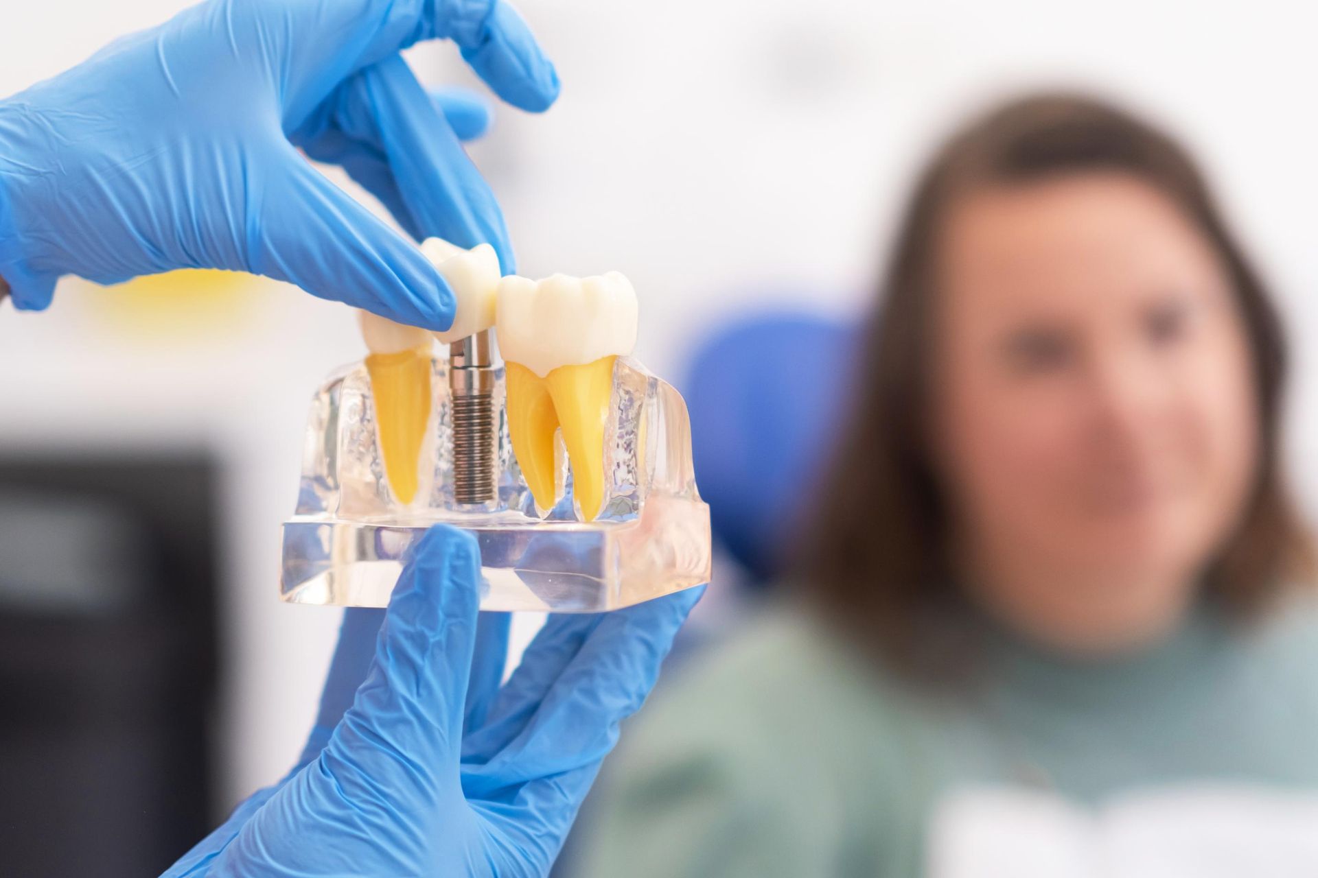 benefits of molar tooth implants