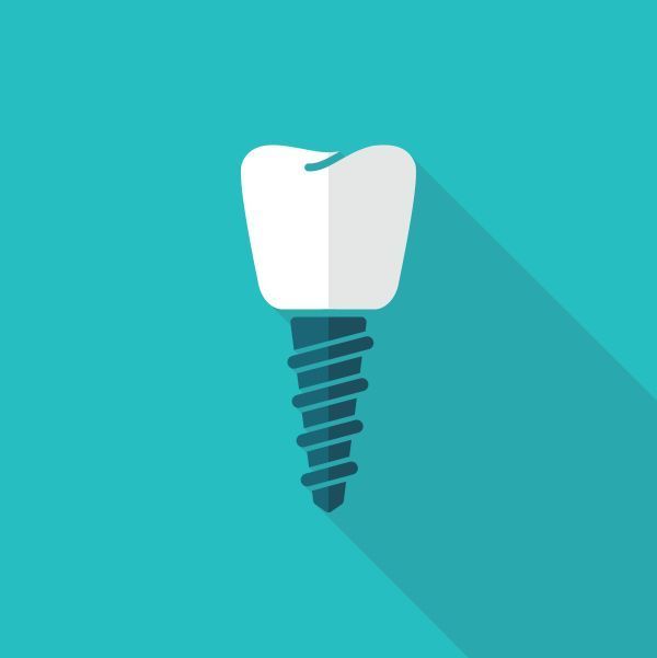 How Dental Implant Surgery Replaces Tooth Roots