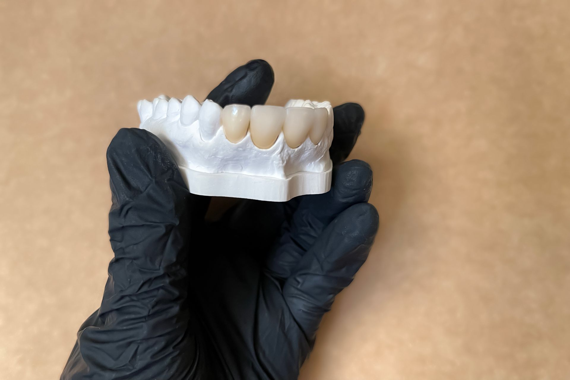 Black-gloved hand holding a clear dental model with white teeth on a tan background