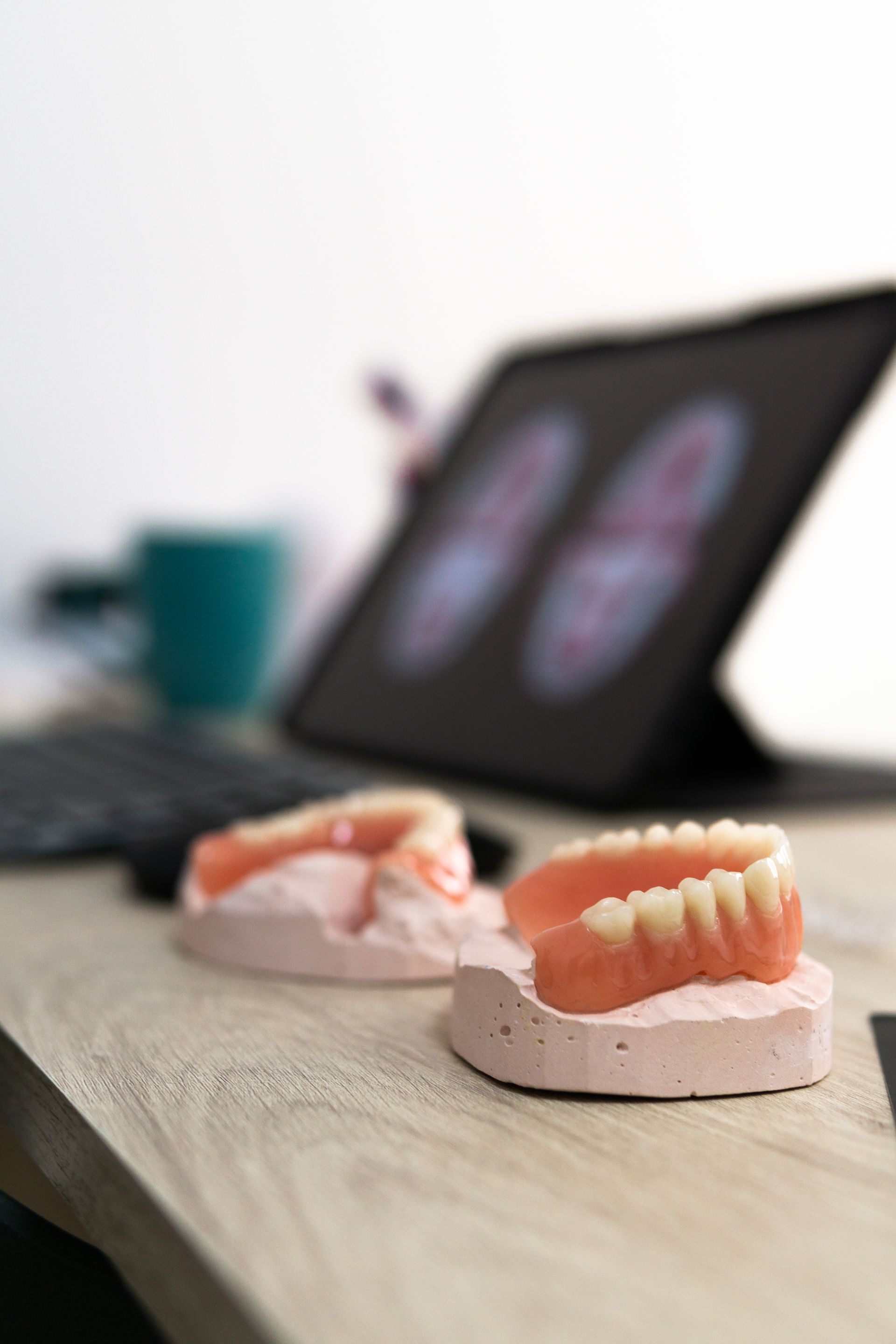 Dental molds on a desk with a blurred laptop and mug in the background
