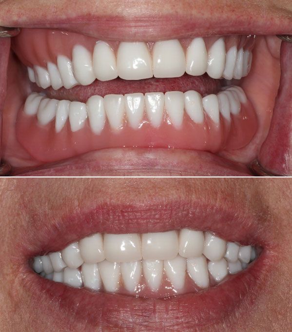 before and after dental in tucson az
