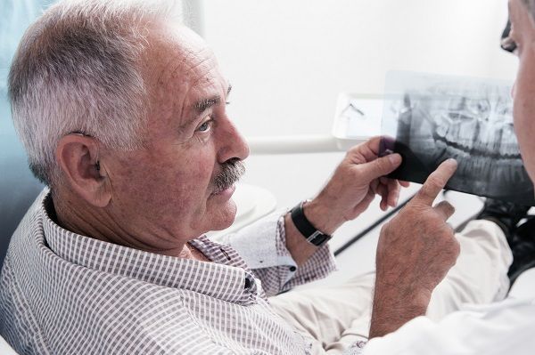 Do I Really Need an Oral Cancer Screening?