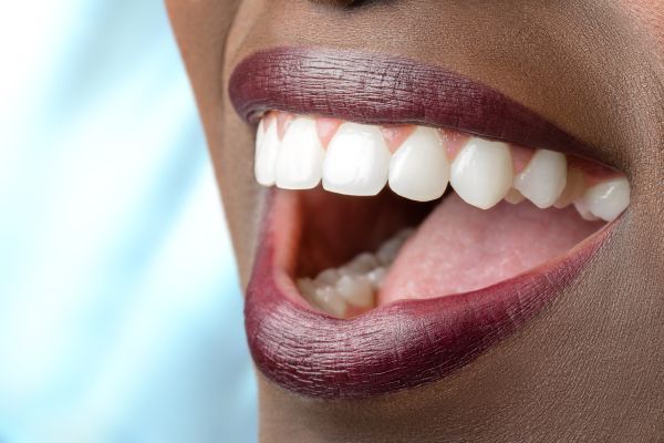 How to Choose the Right Dentist for Periodontics Treatment