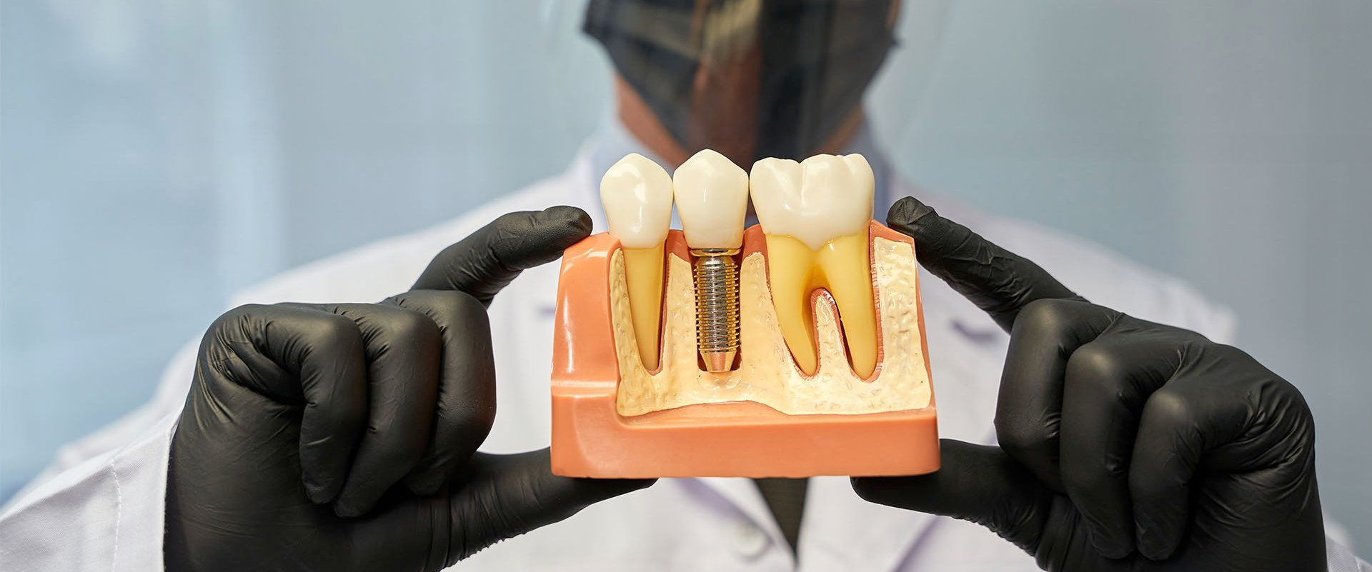 Dentist in mask holding a dental model showing healthy tooth, implant, and decayed tooth.