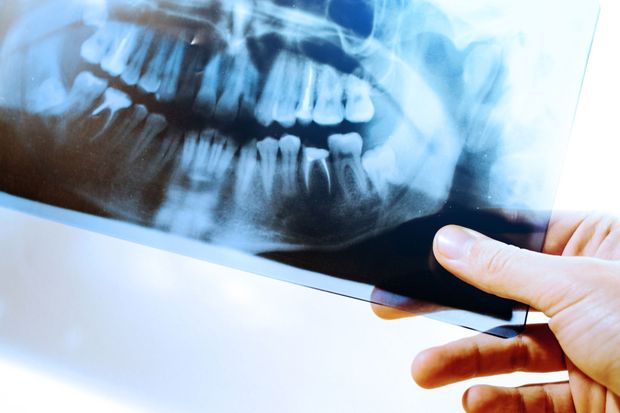 Conservativa e radiologia