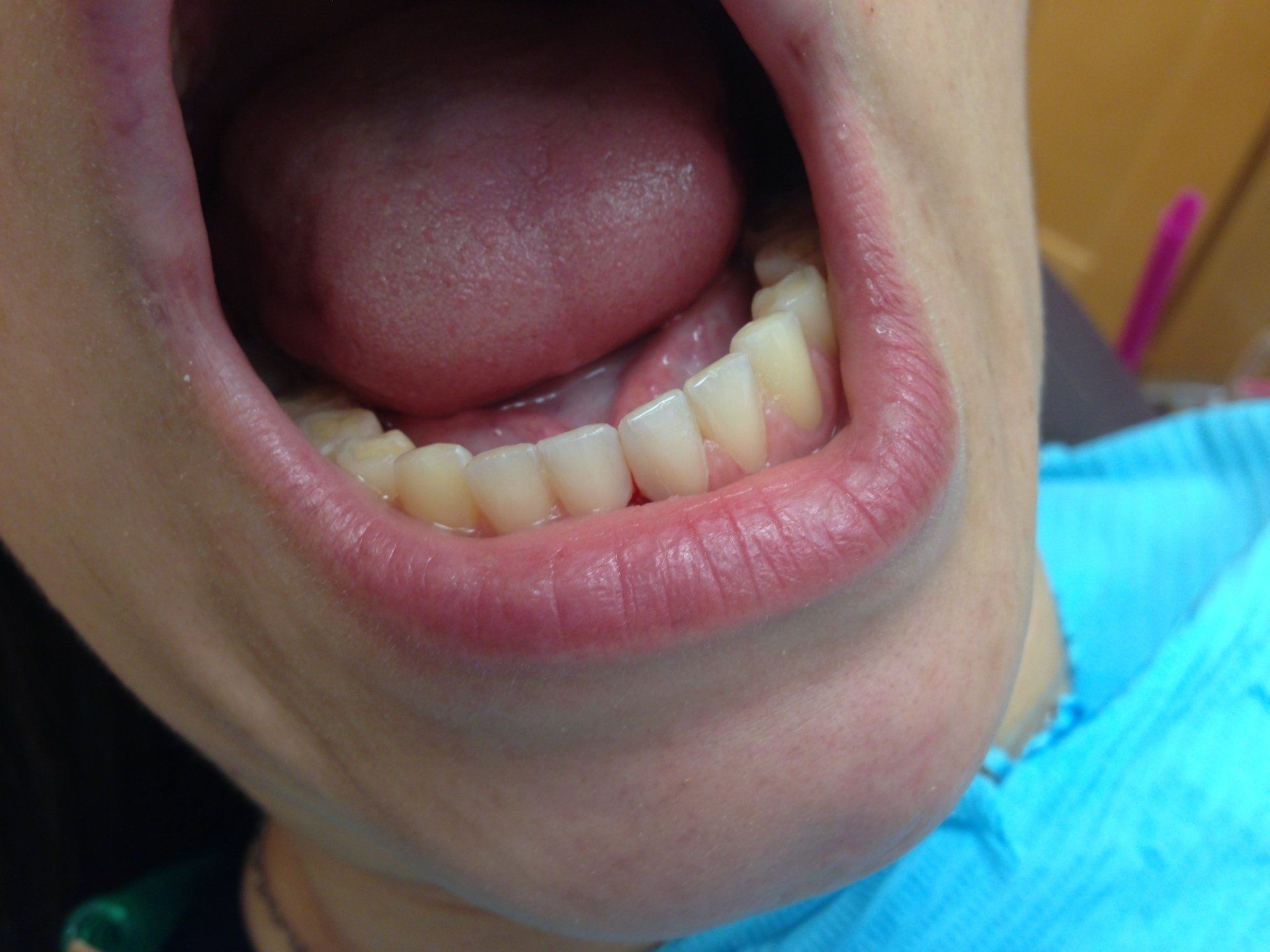 A close up of a person 's mouth with their tongue sticking out