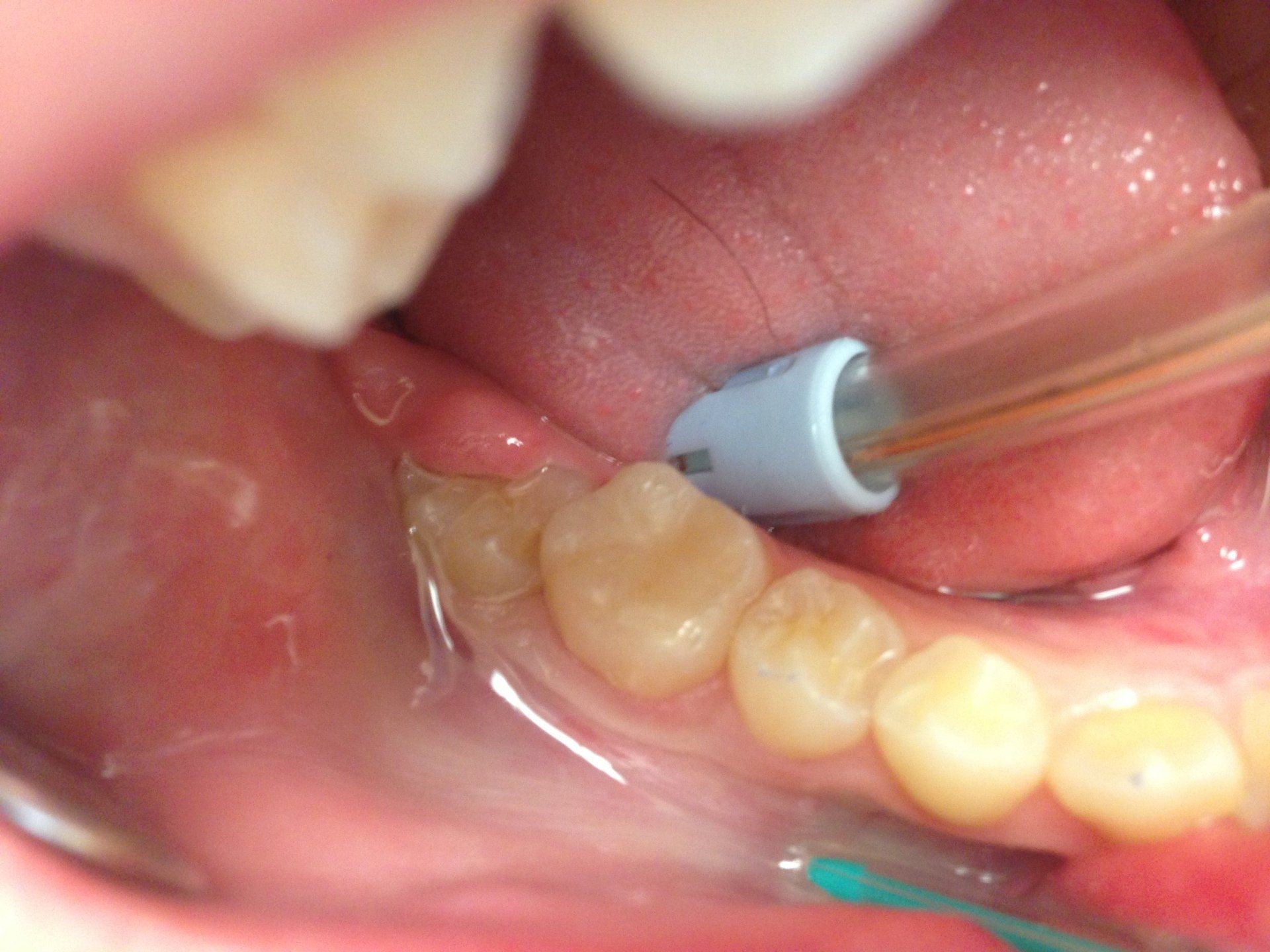 A close up of a person 's mouth with a toothbrush in it