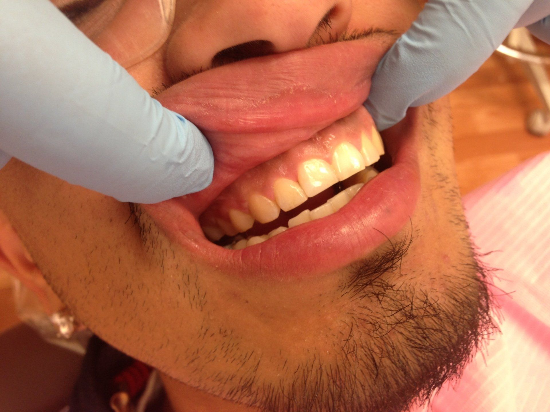 A man is getting his teeth examined by a dentist