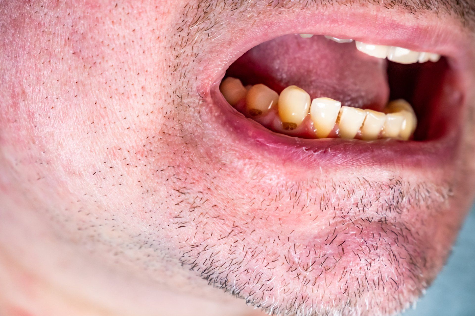 A close up of a man 's mouth with a beard and teeth.
